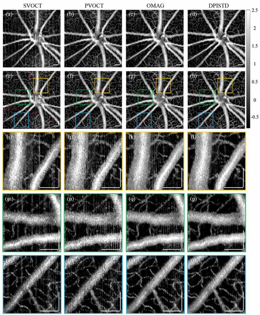 融合差分相位与强度图像提升视网膜OCTA活体成像质量——《Optics Letters》论文