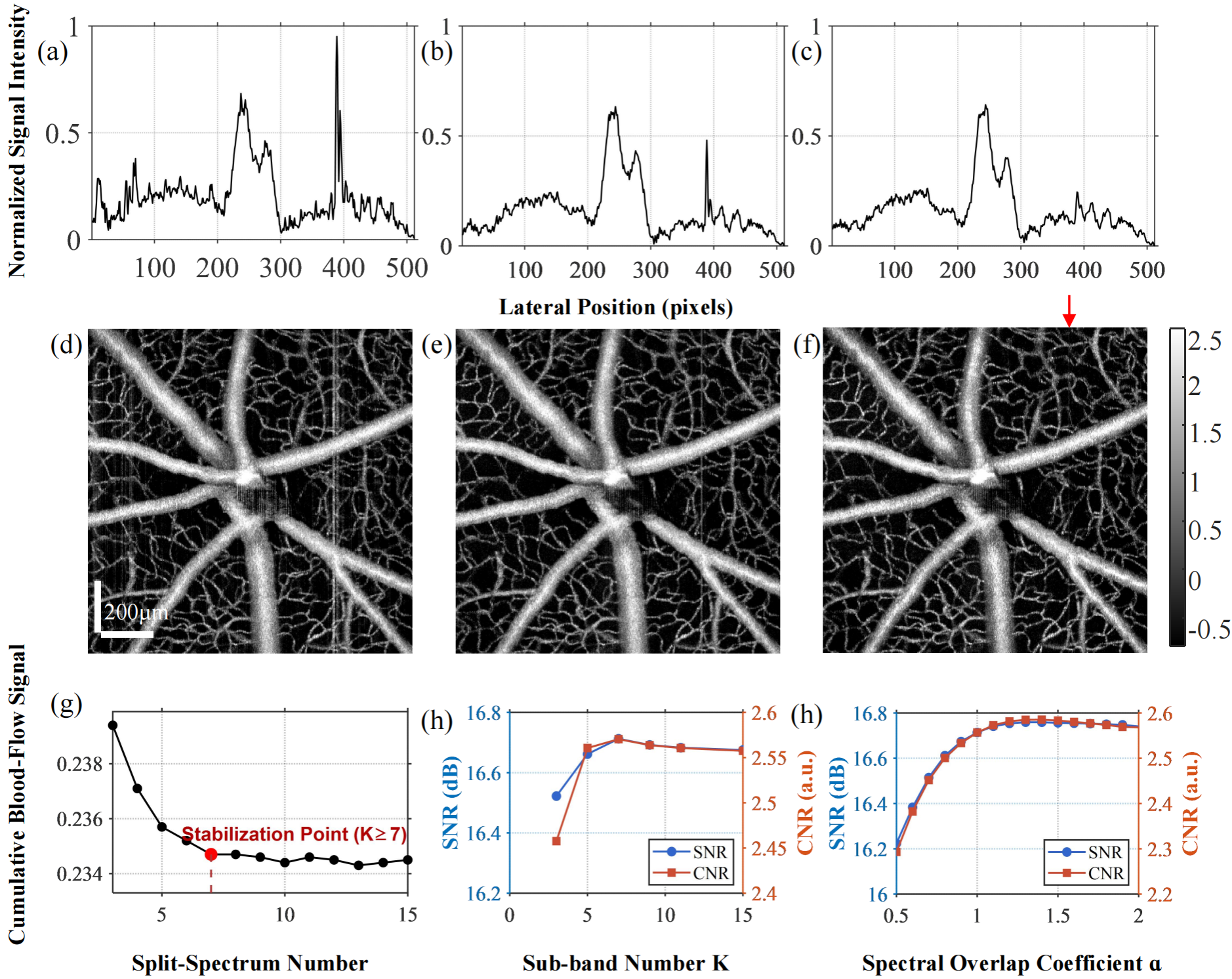 分谱双域相位强度融合光学相干断层扫描血管造影——《Optics Letters》论文
